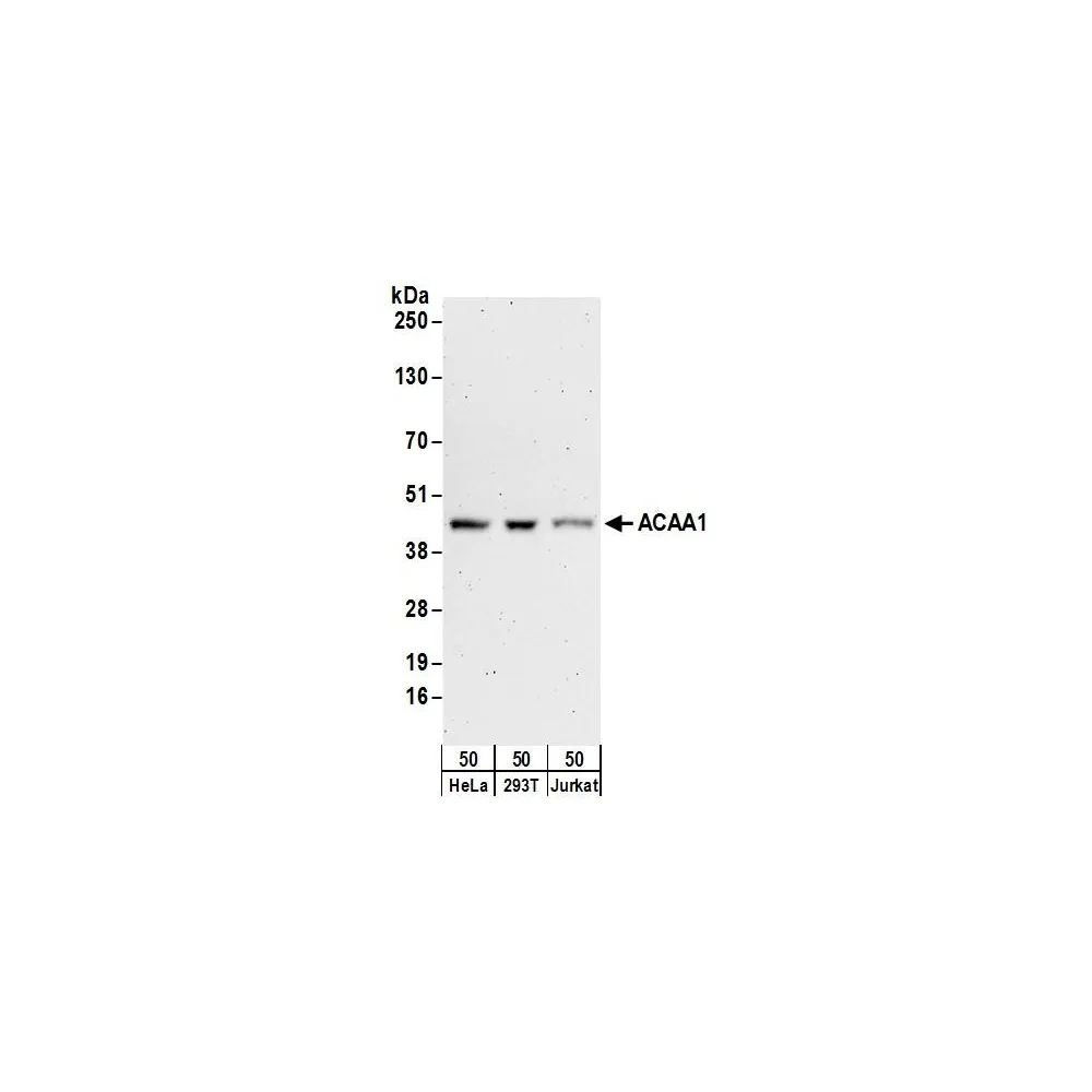 Rabbit anti-ACAA1 Antibody, Affinity Purified