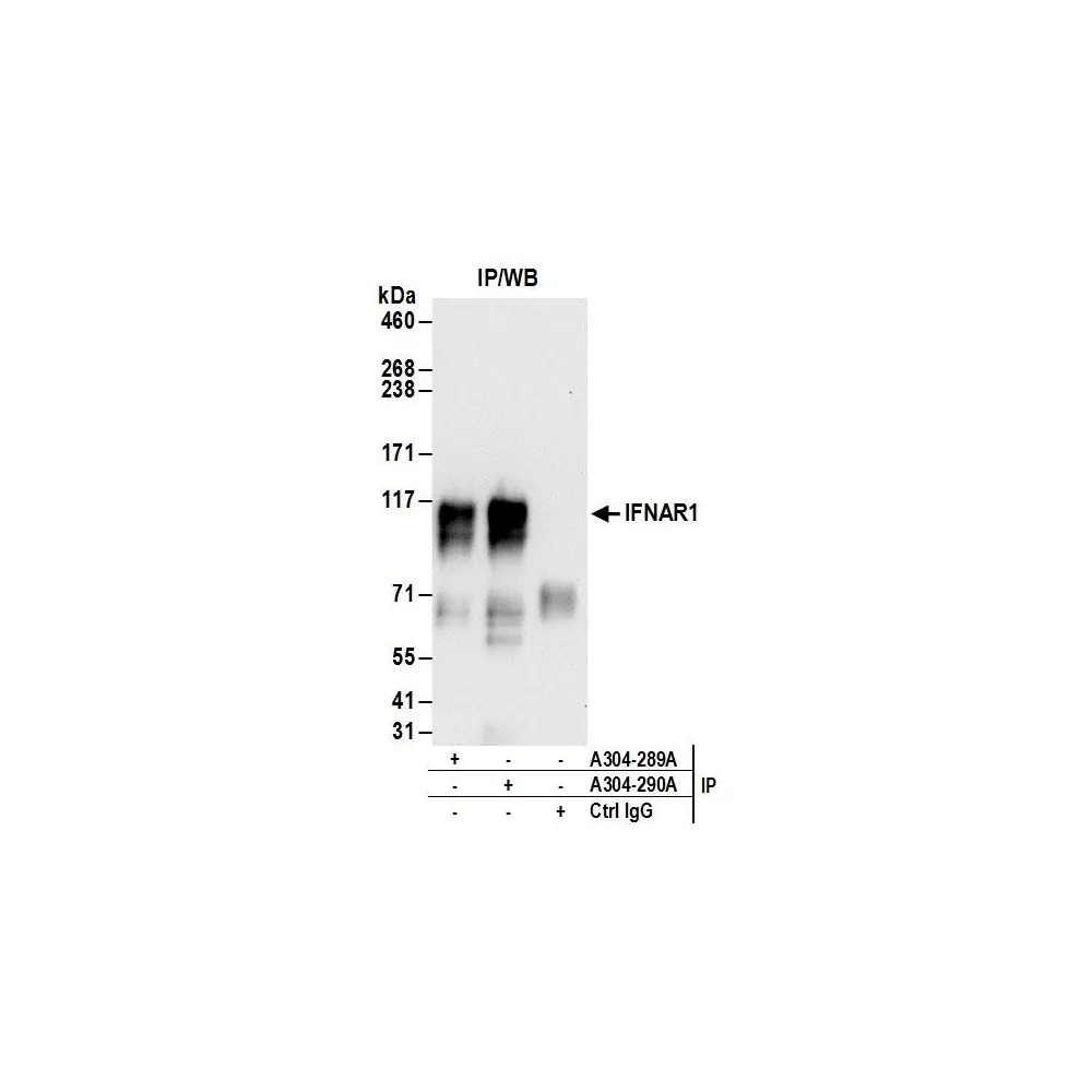 Rabbit anti-IFNAR1 Antibody, Affinity Purified