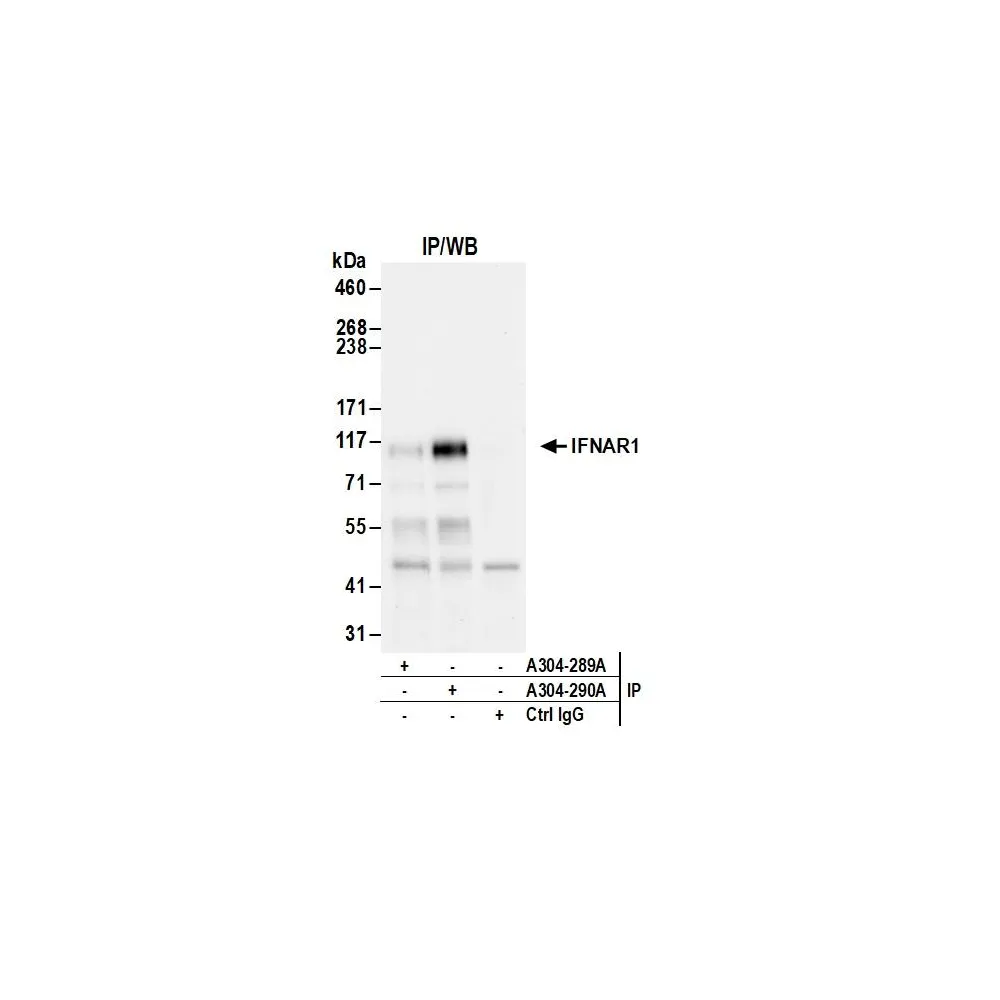 Rabbit anti-IFNAR1 Antibody, Affinity Purified
