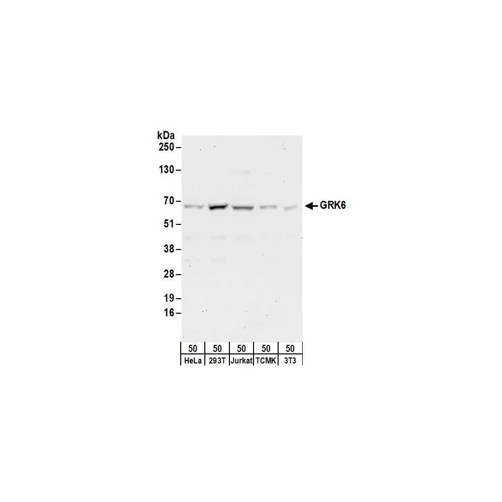 Rabbit anti-GRK6 Antibody, Affinity Purified