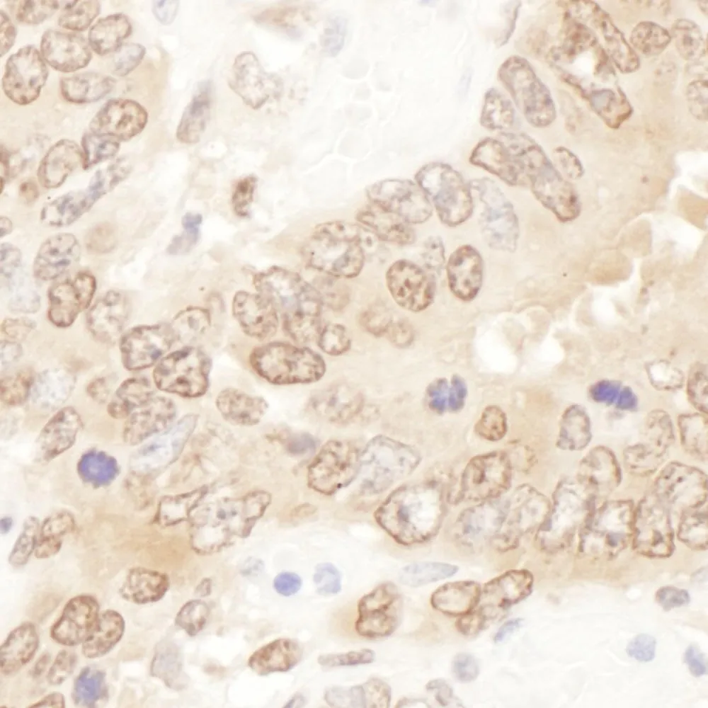Rabbit anti-ACAT2 Antibody, Affinity Purified