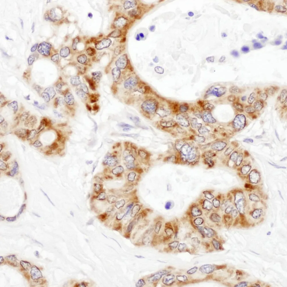 Rabbit anti-DLST Antibody, Affinity Purified