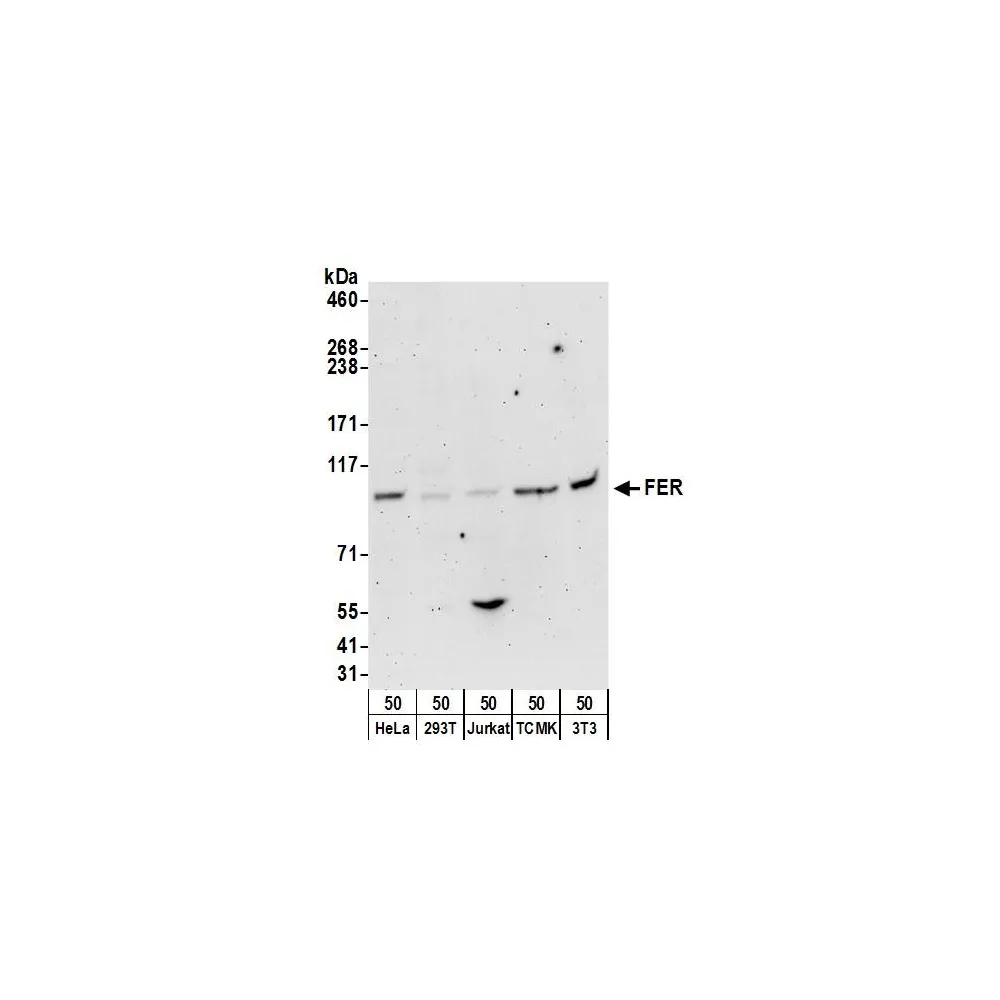 Rabbit anti-FER Antibody, Affinity Purified