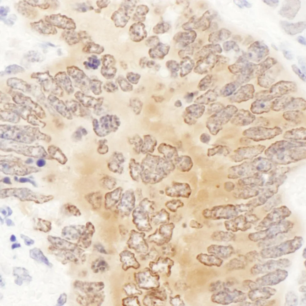Rabbit anti-GART Antibody, Affinity Purified