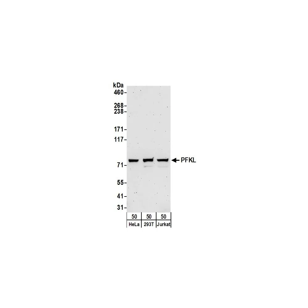 Rabbit anti-PFKL Antibody, Affinity Purified