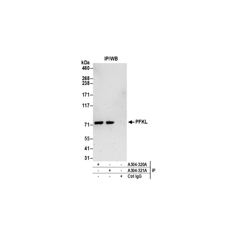 Rabbit anti-PFKL Antibody, Affinity Purified
