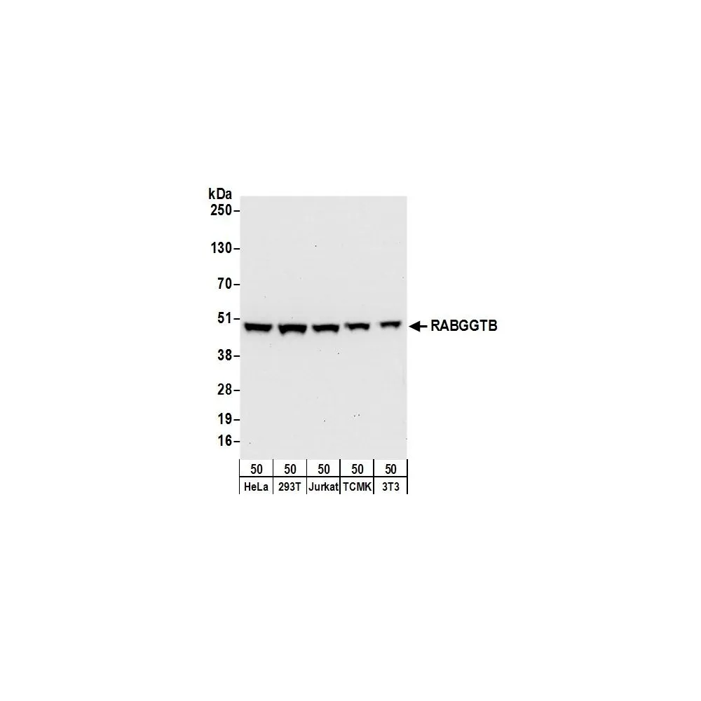 Rabbit anti-RABGGTB Antibody, Affinity Purified
