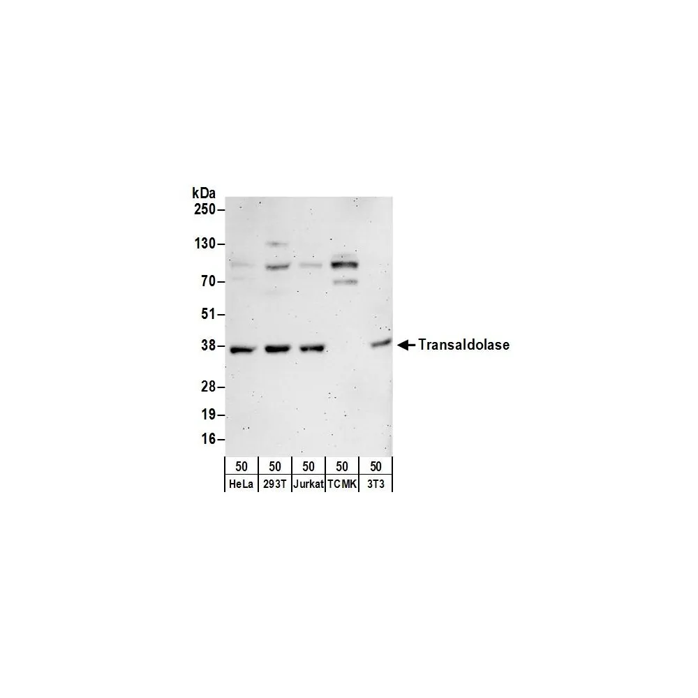 Rabbit anti-Transaldolase Antibody, Affinity Purified