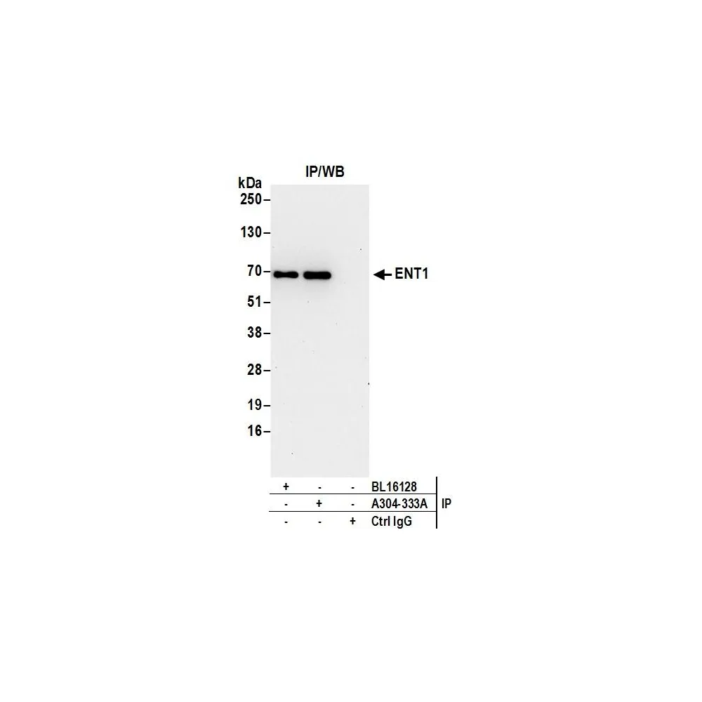 Rabbit anti-ENT1 Antibody, Affinity Purified