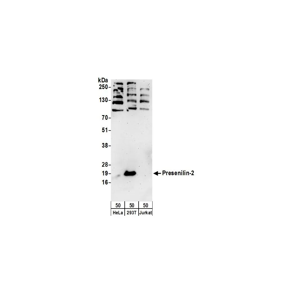 Rabbit anti-Presenilin-2 Antibody, Affinity Purified