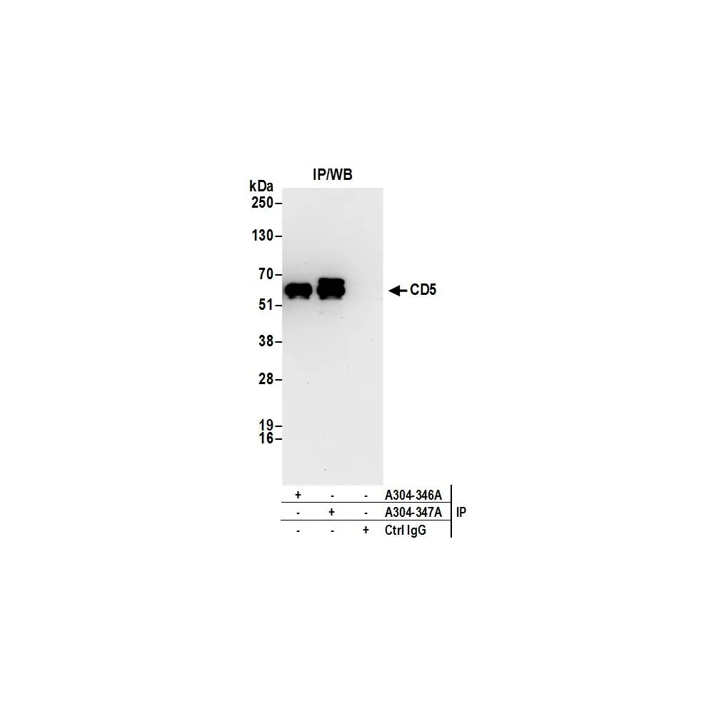 Rabbit anti-CD5 Antibody, Affinity Purified