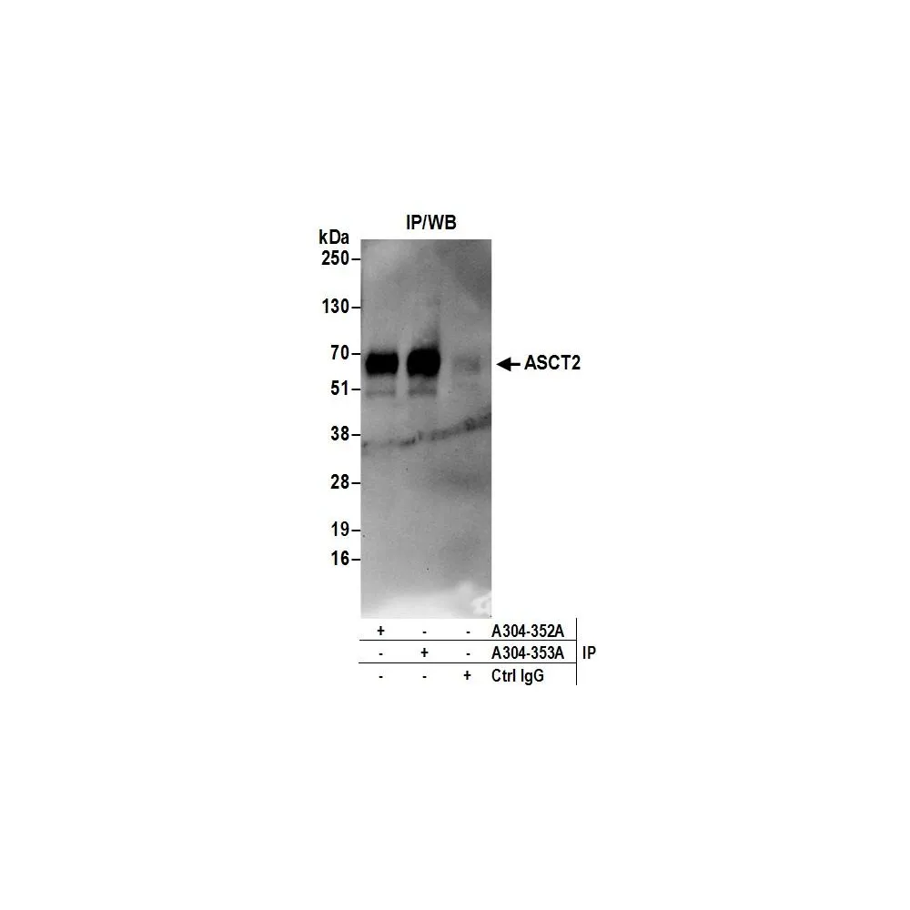 Rabbit anti-ASCT2 Antibody, Affinity Purified
