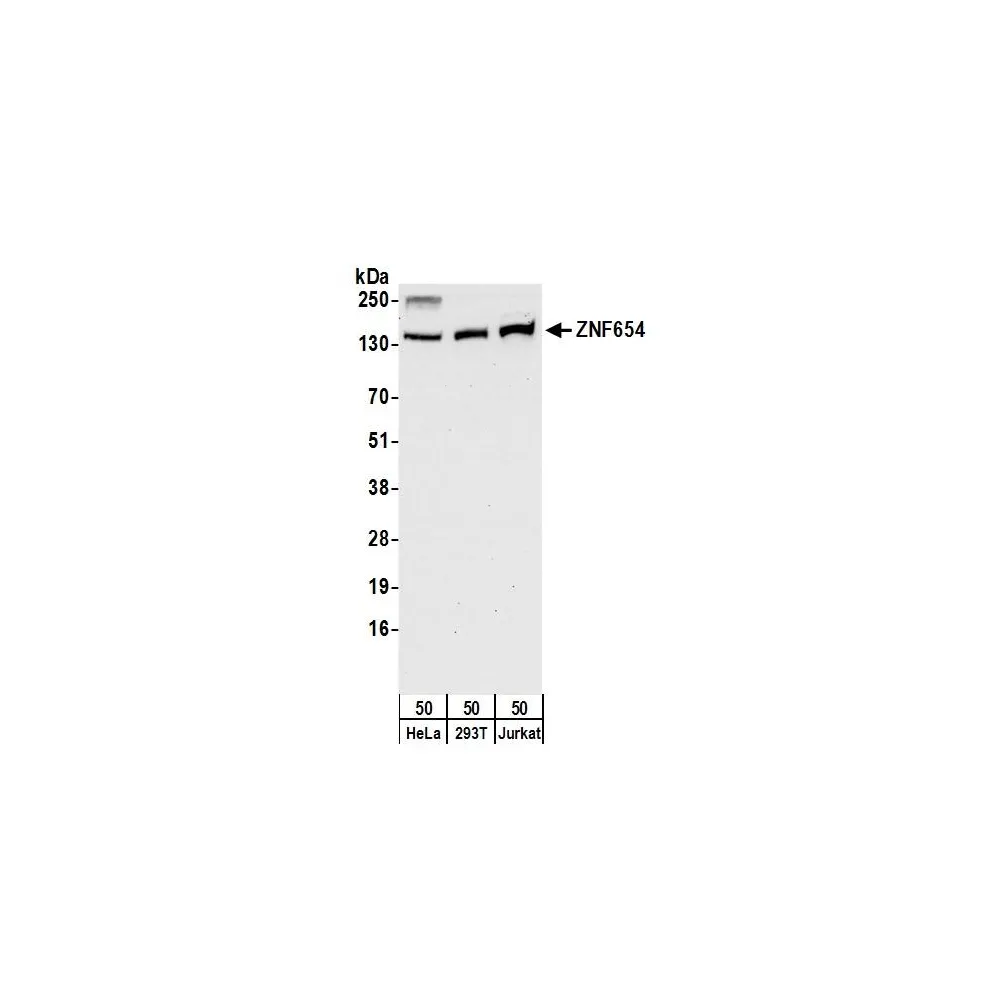 Rabbit anti-ZNF654 Antibody, Affinity Purified