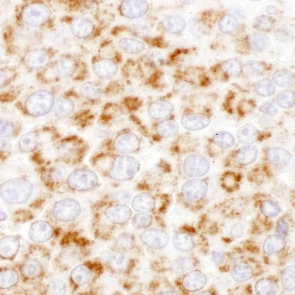 Rabbit anti-GOT2 Antibody, Affinity Purified