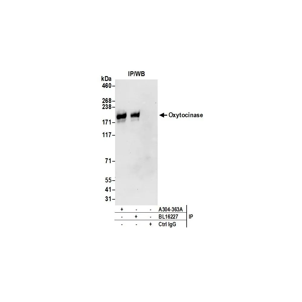 Rabbit anti-Oxytocinase Antibody, Affinity Purified