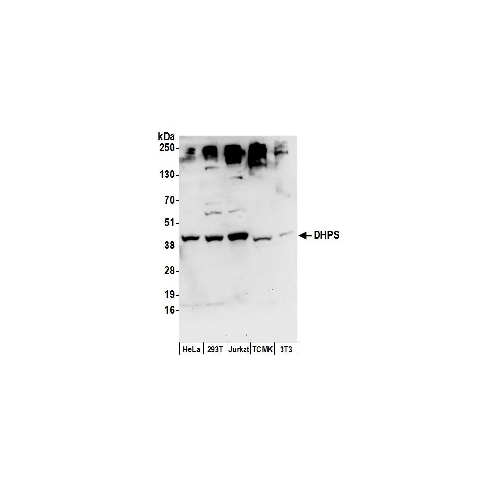 Rabbit anti-DHPS Antibody, Affinity Purified