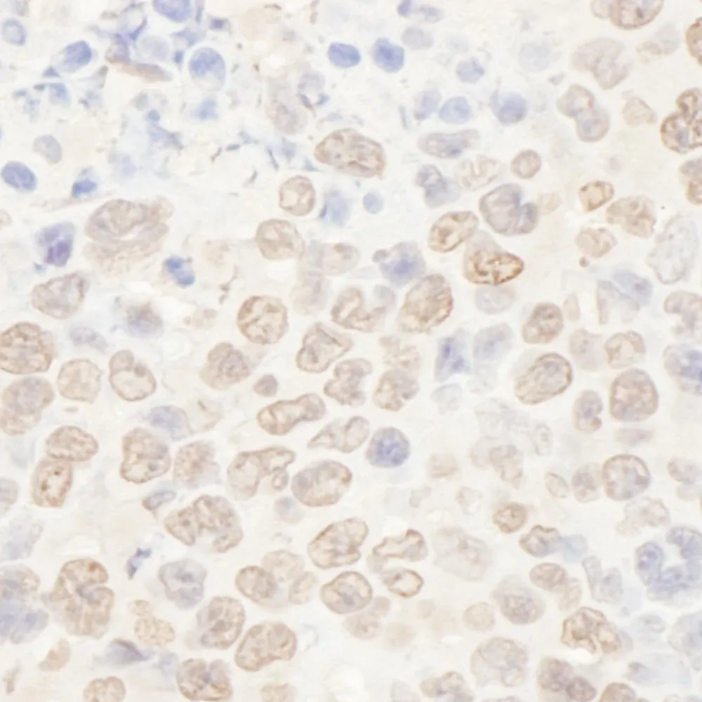 Rabbit anti-NAT10 Antibody, Affinity Purified