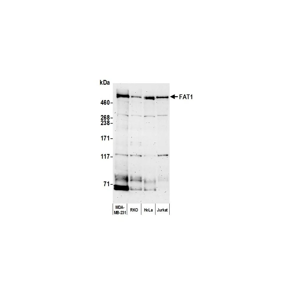 Rabbit anti-FAT1 Antibody, Affinity Purified