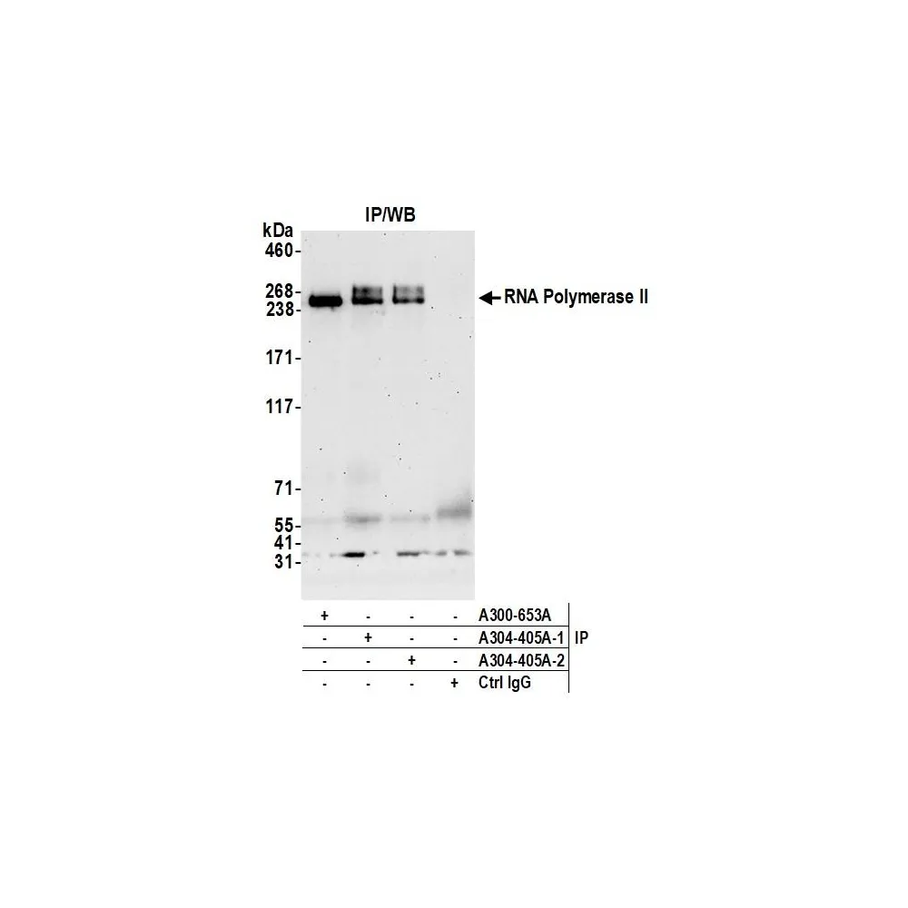 Rabbit anti-RNA Polymerase II Antibody, Affinity Purified