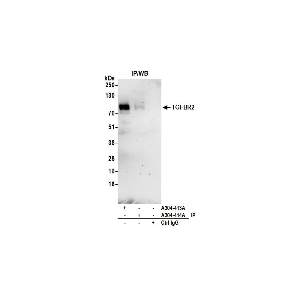 Rabbit anti-TGFBR2 Antibody, Affinity Purified