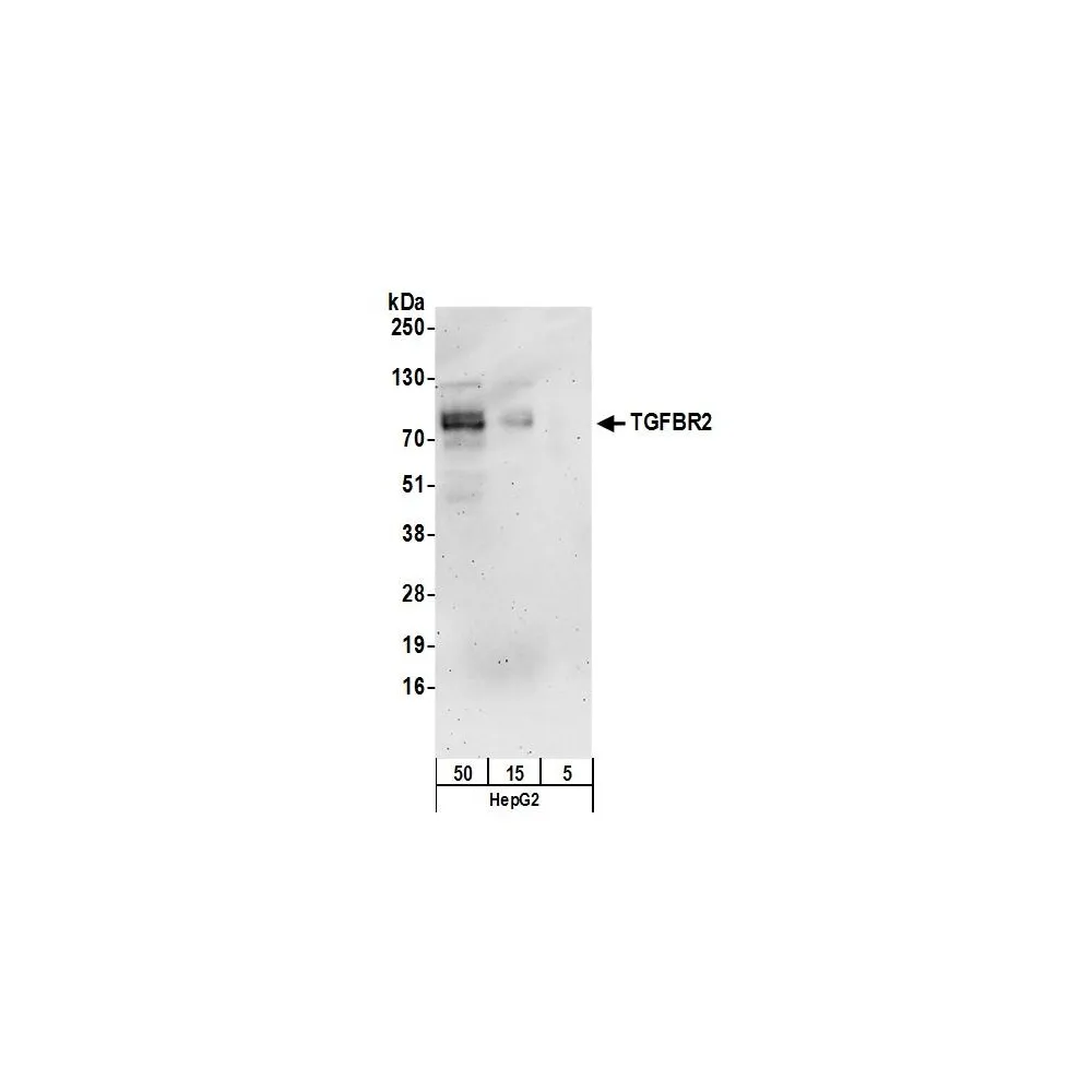 Rabbit anti-TGFBR2 Antibody, Affinity Purified