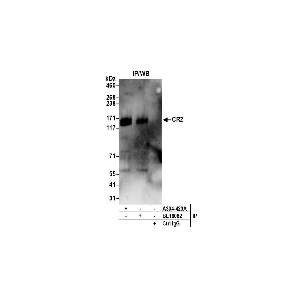 Rabbit anti-CR2 Antibody, Affinity Purified