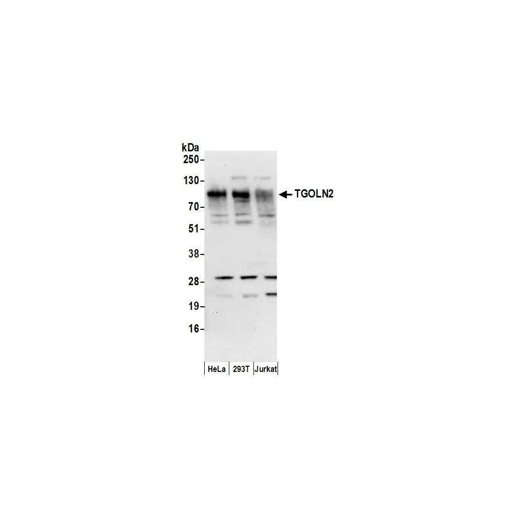 Rabbit anti-TGOLN2 Antibody, Affinity Purified