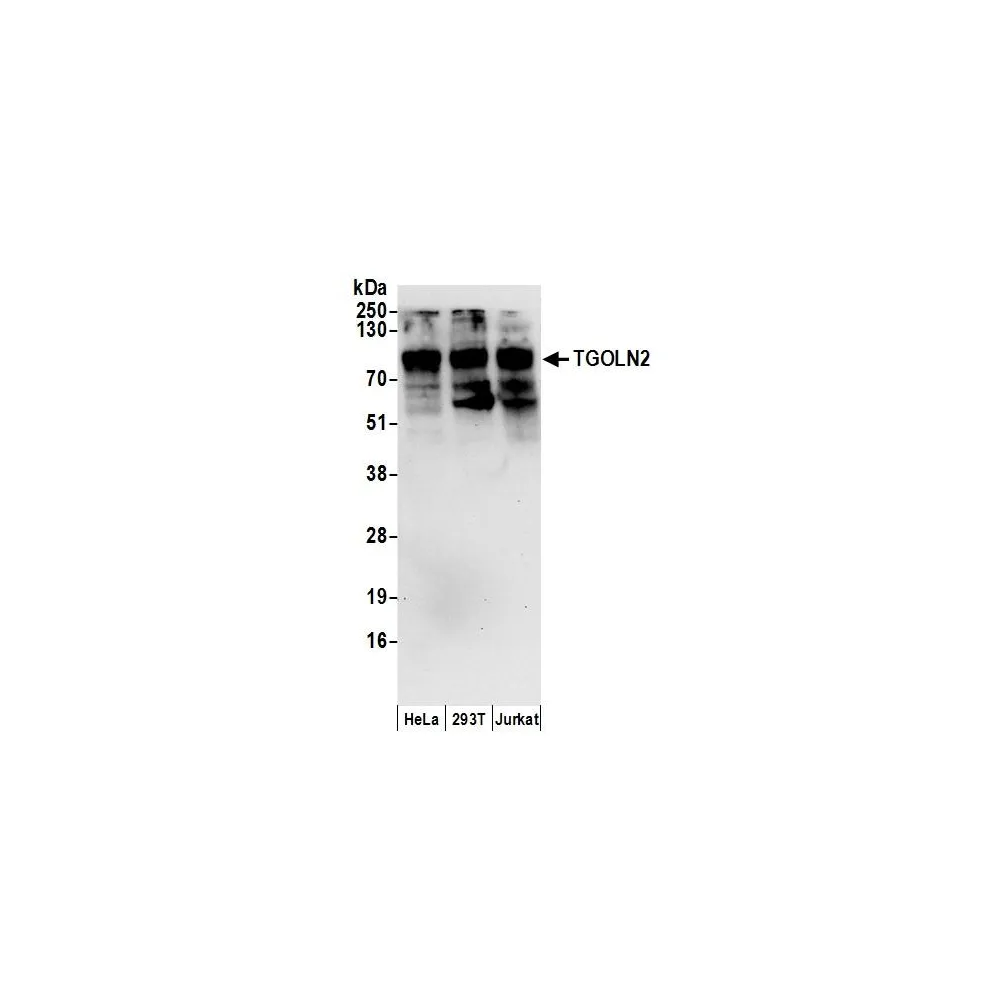 Rabbit anti-TGOLN2 Antibody, Affinity Purified