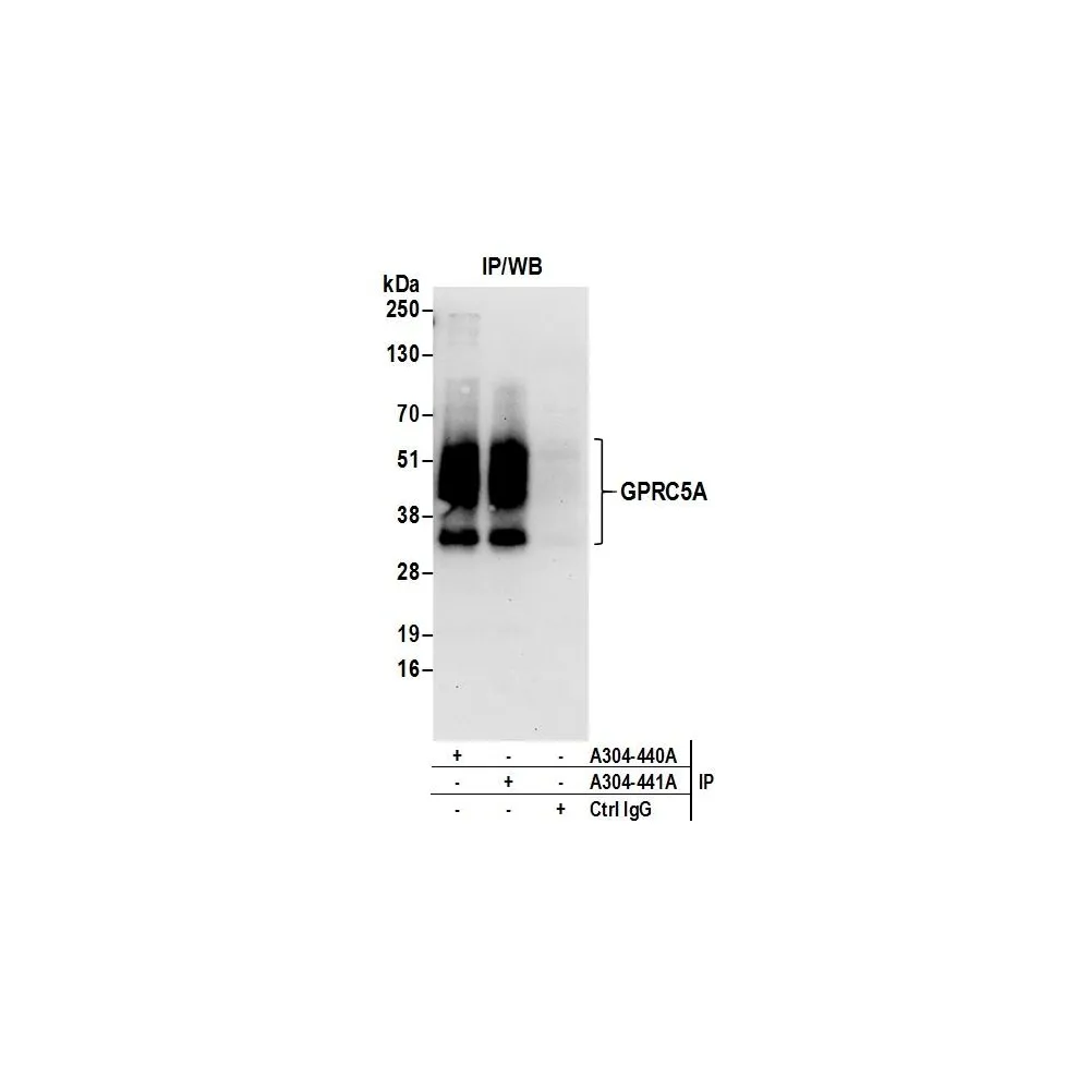 Rabbit anti-GPRC5A Antibody, Affinity Purified