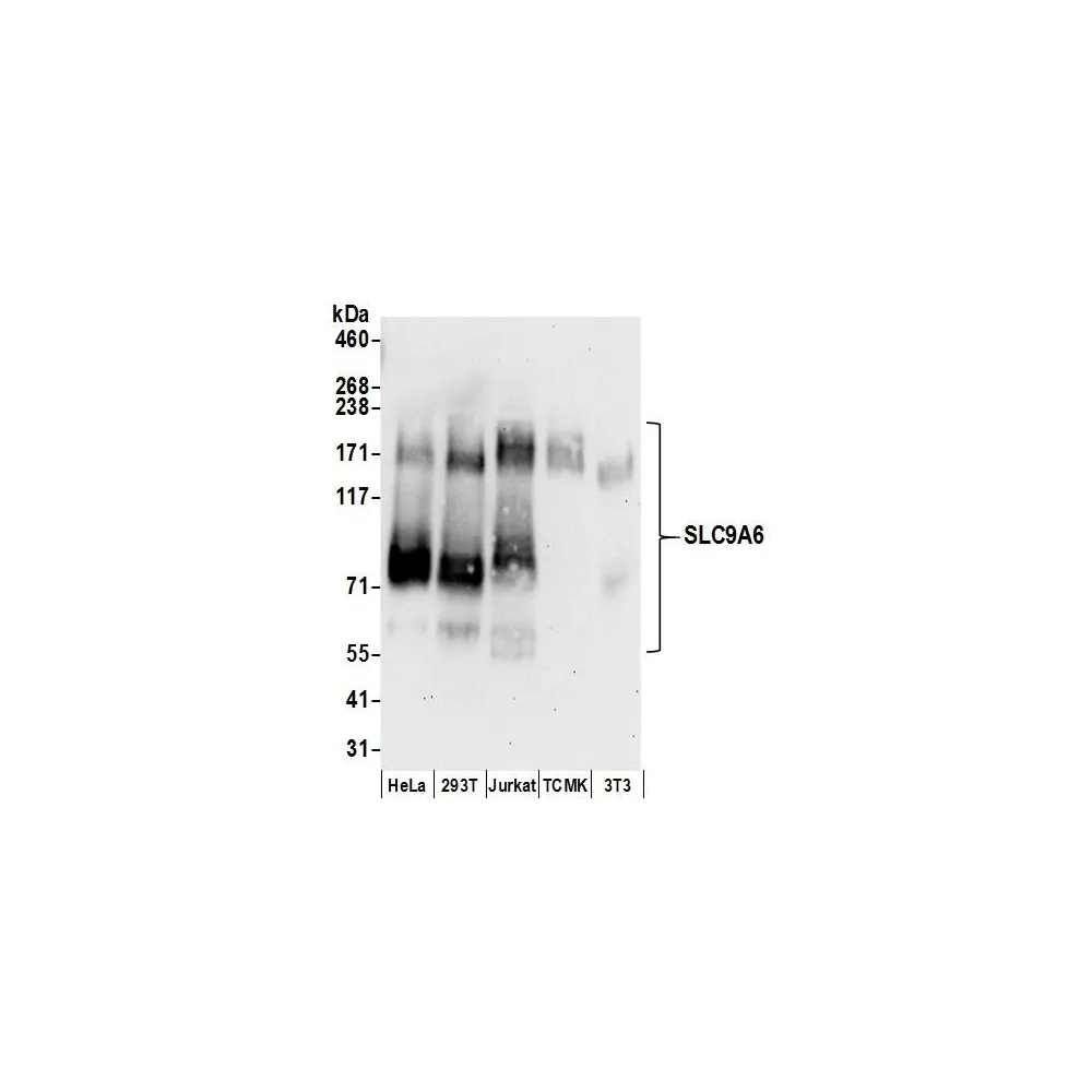 Rabbit anti-SLC9A6 Antibody, Affinity Purified