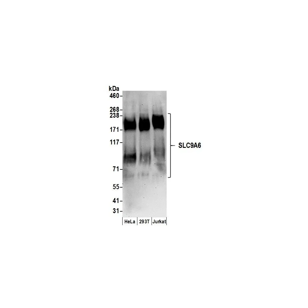 Rabbit anti-SLC9A6 Antibody, Affinity Purified