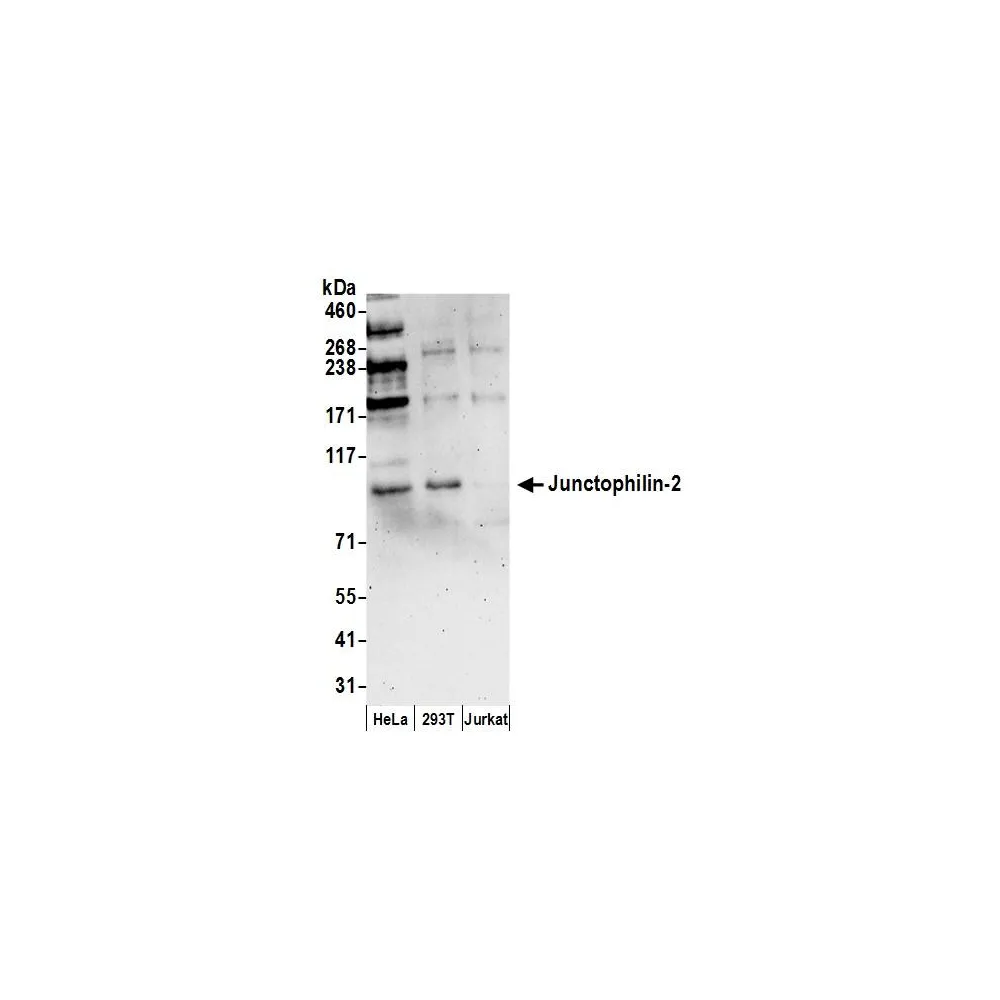 Rabbit anti-Junctophilin-2 Antibody, Affinity Purified