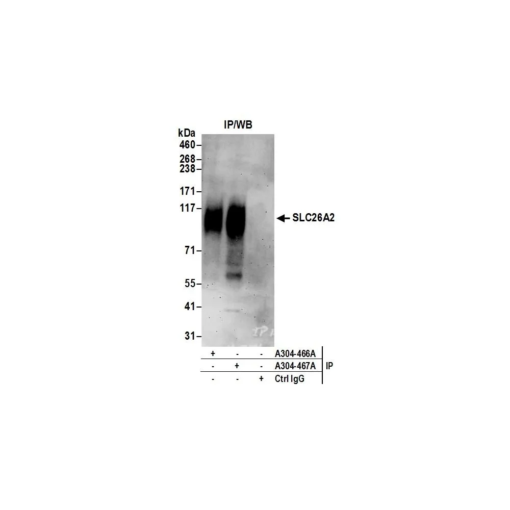 Rabbit anti-SLC26A2 Antibody, Affinity Purified