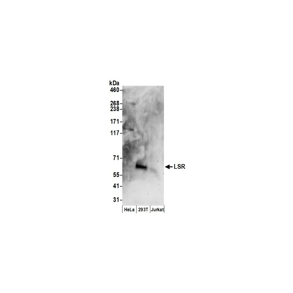 Rabbit anti-LSR Antibody, Affinity Purified