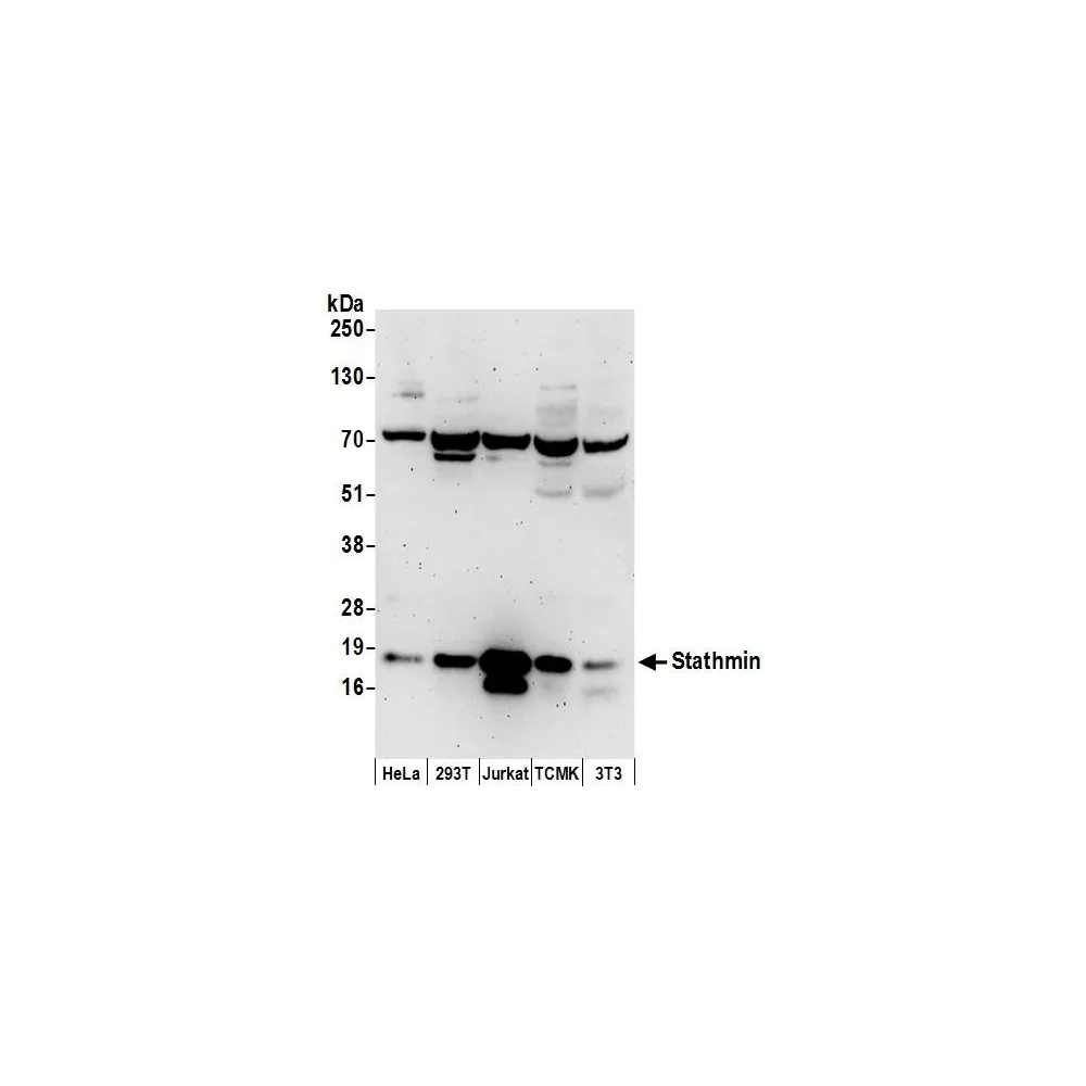 Rabbit anti-Stathmin Antibody, Affinity Purified