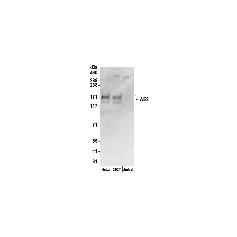 Rabbit anti-AE2 Antibody, Affinity Purified