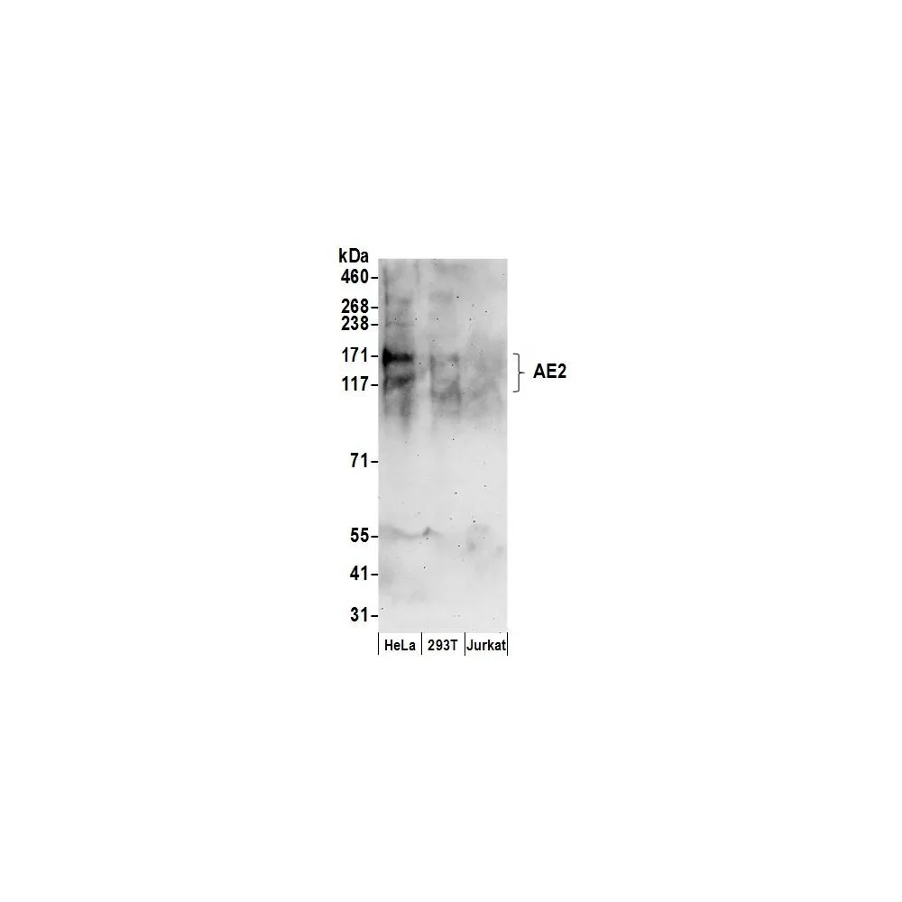 Rabbit anti-AE2 Antibody, Affinity Purified