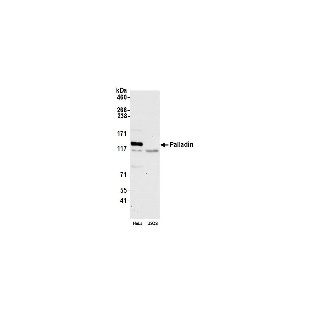 Rabbit anti-Palladin Antibody, Affinity Purified