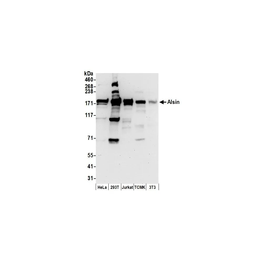 Rabbit anti-Alsin Antibody, Affinity Purified
