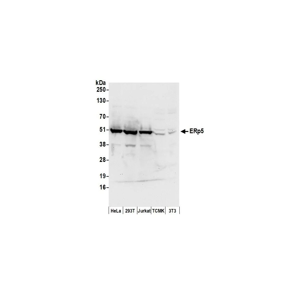 Rabbit anti-ERp5 Antibody, Affinity Purified