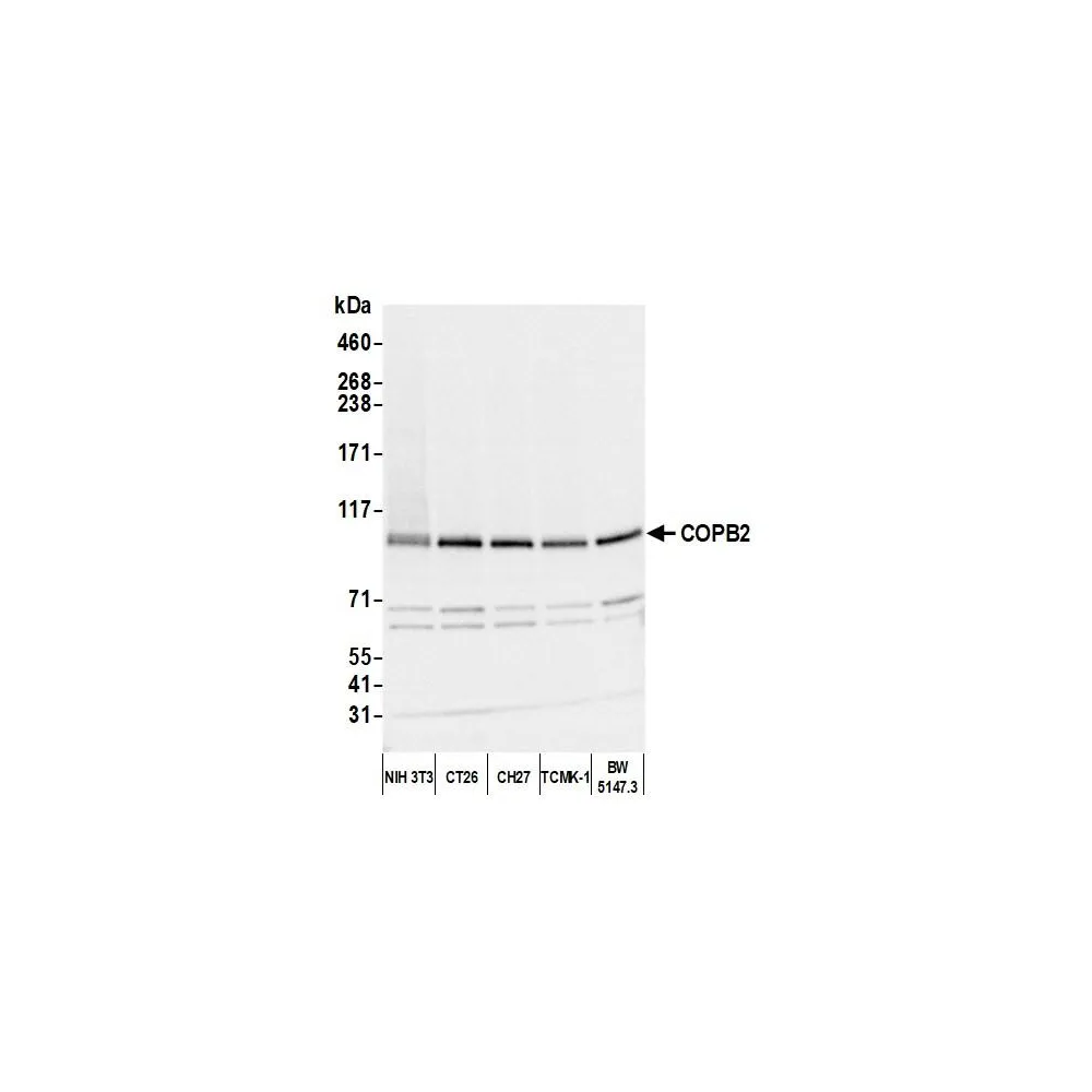 Rabbit anti-COPB2 Antibody, Affinity Purified