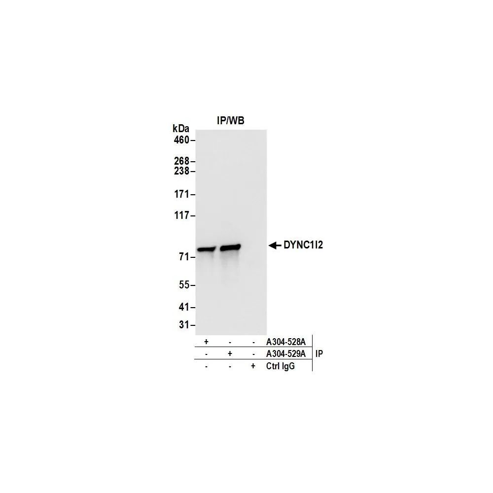 Rabbit anti-DYNC1I2 Antibody, Affinity Purified