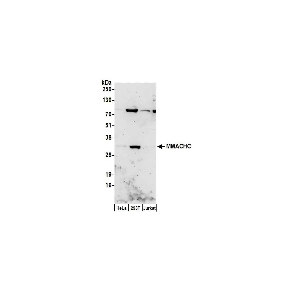 Rabbit anti-MMACHC Antibody, Affinity Purified