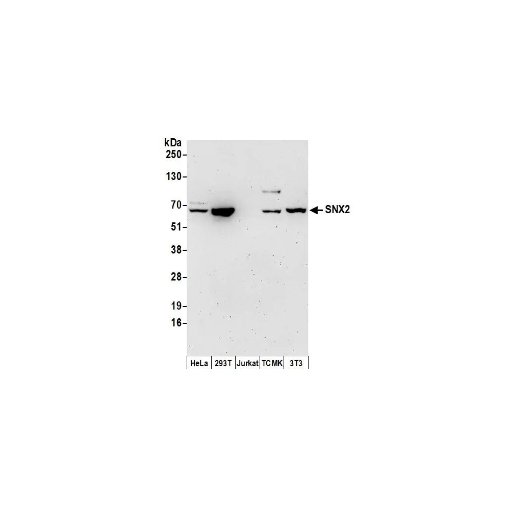 Rabbit anti-SNX2 Antibody, Affinity Purified
