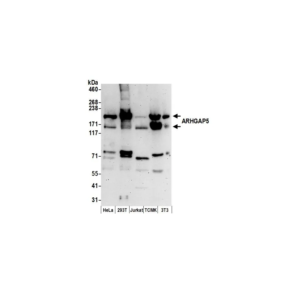 Rabbit anti-ARHGAP5 Antibody, Affinity Purified