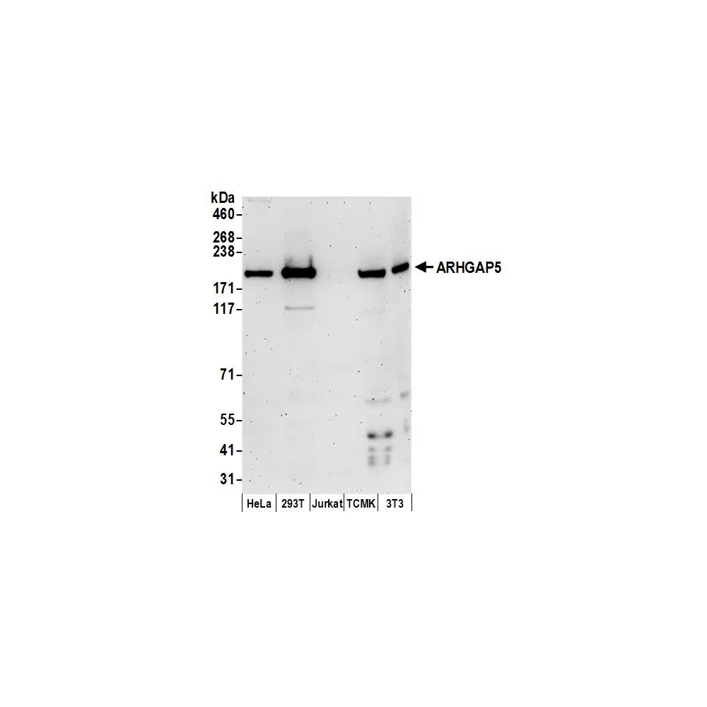 Rabbit anti-ARHGAP5 Antibody, Affinity Purified