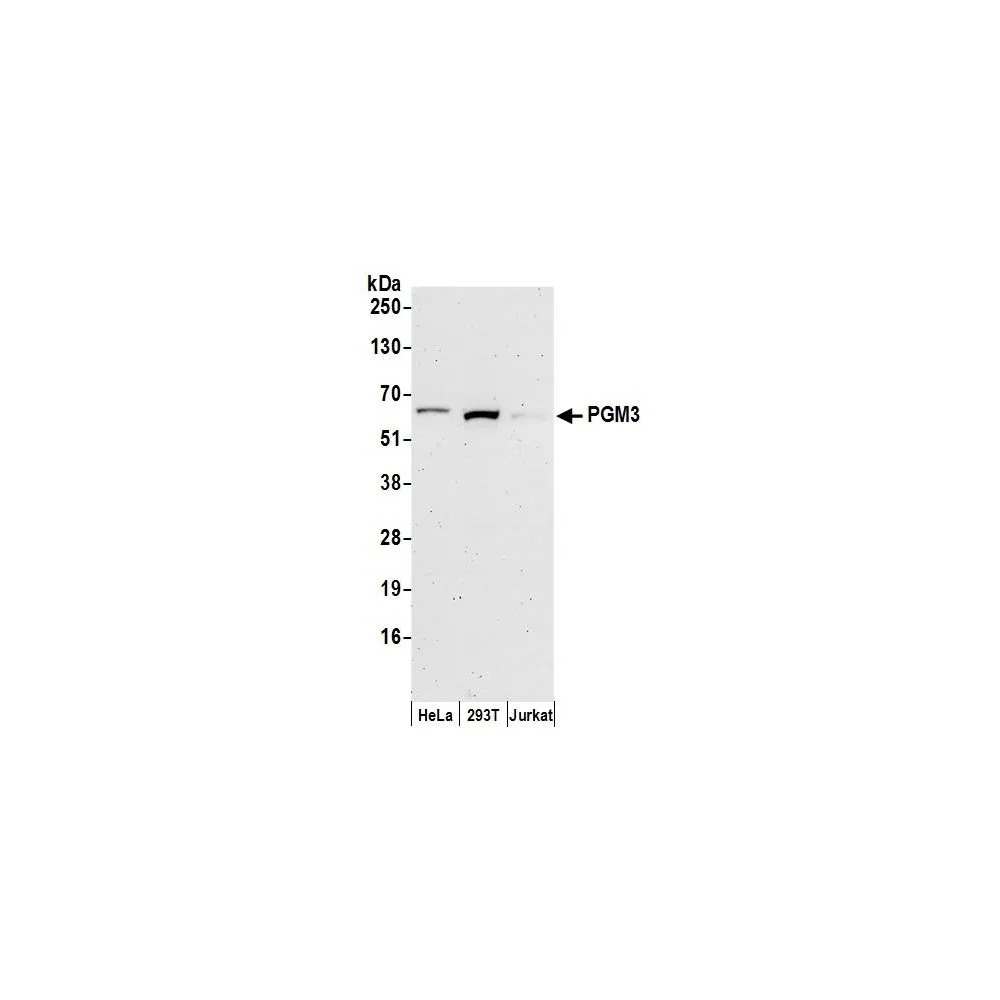 Rabbit anti-PGM3 Antibody, Affinity Purified