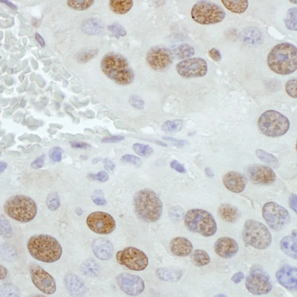 Rabbit anti-PCYT1A Antibody, Affinity Purified