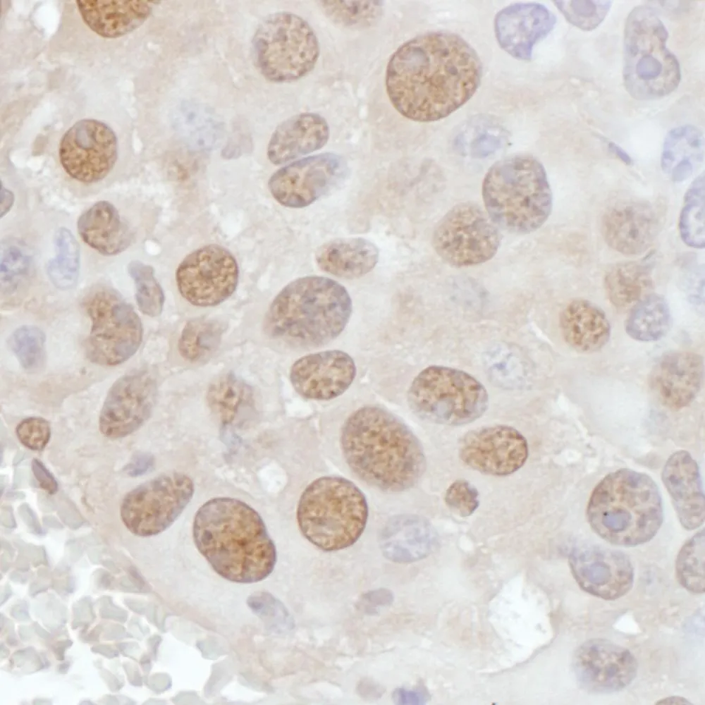 Rabbit anti-PCYT1A Antibody, Affinity Purified