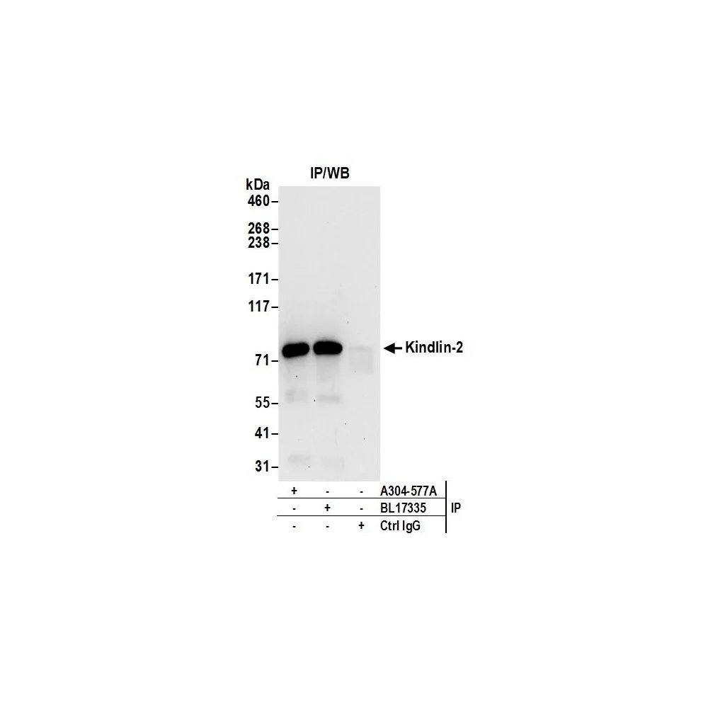 Rabbit anti-Kindlin-2 Antibody, Affinity Purified